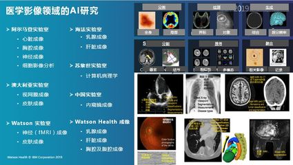IBM Watson Health:AI醫(yī)療堅(jiān)定的“長跑者”