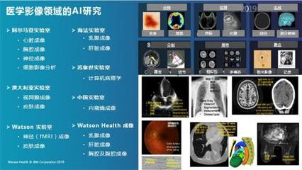 IBM Watson Health:AI醫(yī)療堅定的“長跑者”