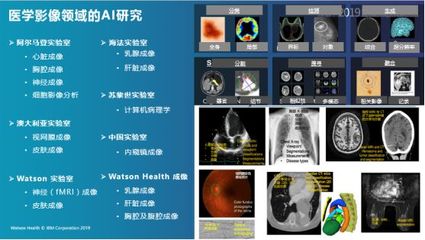 IBM Watson Health:AI助力智慧醫療新未來